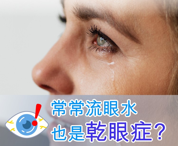 常常流眼水也是乾眼症？