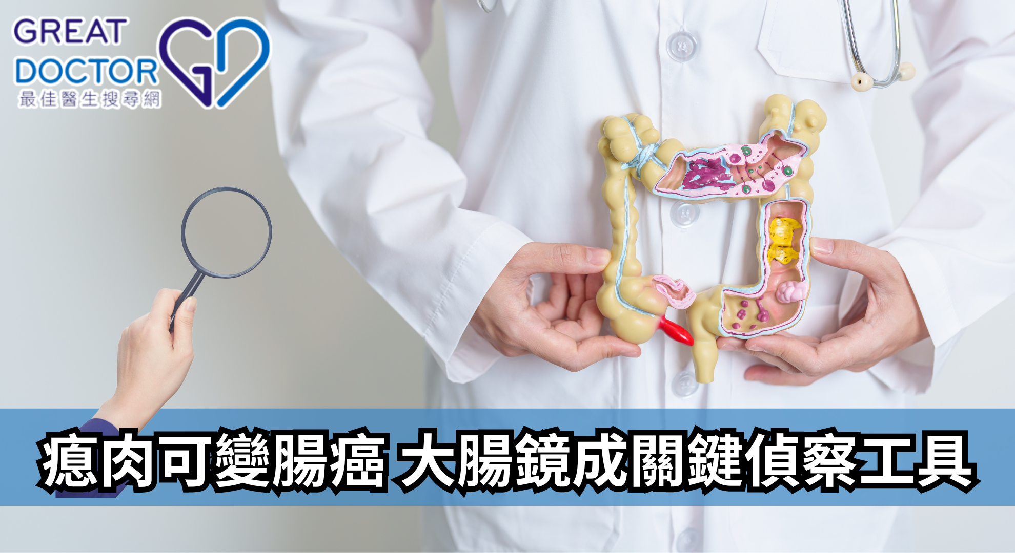 瘜肉可變腸癌 大腸鏡成關鍵偵察工具