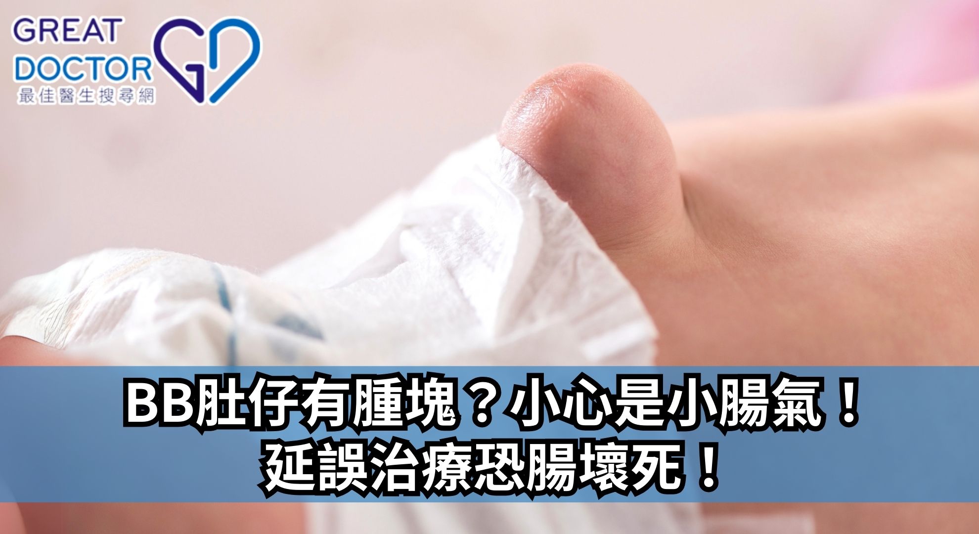 BB肚仔有腫塊？小心是小腸氣！延誤治療恐腸壞死！